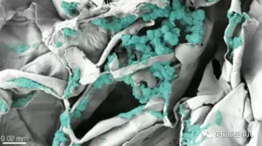 在苹果片上“种”出人耳？！这不是恐怖故事，是脑洞大开的医学新方向啊喂！