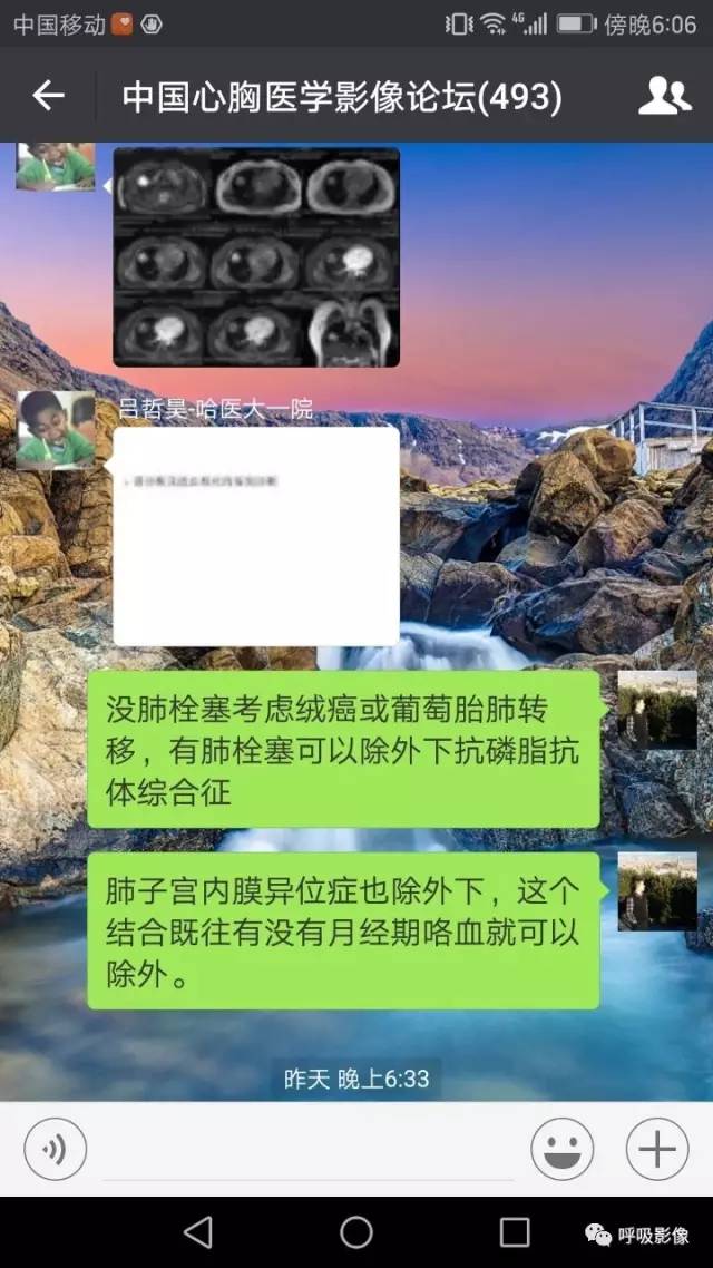 绒毛膜癌转移到脑,绒毛膜癌肺转移