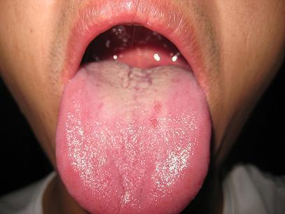 湿气重不重该怎么判断有效祛湿,湿气重生百病老中医推荐祛湿方