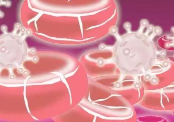 血小板减少性紫癜是大病吗好治吗,血小板减少紫癜是什么病能治好吗