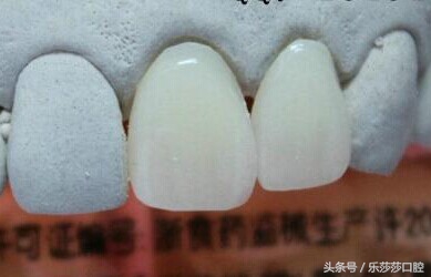 为什么牙医爱忽悠人做烤瓷牙,牙医的真相大全
