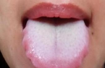 湿气重的人一看症状知道了,湿气重的17种症状99%的人都中招了