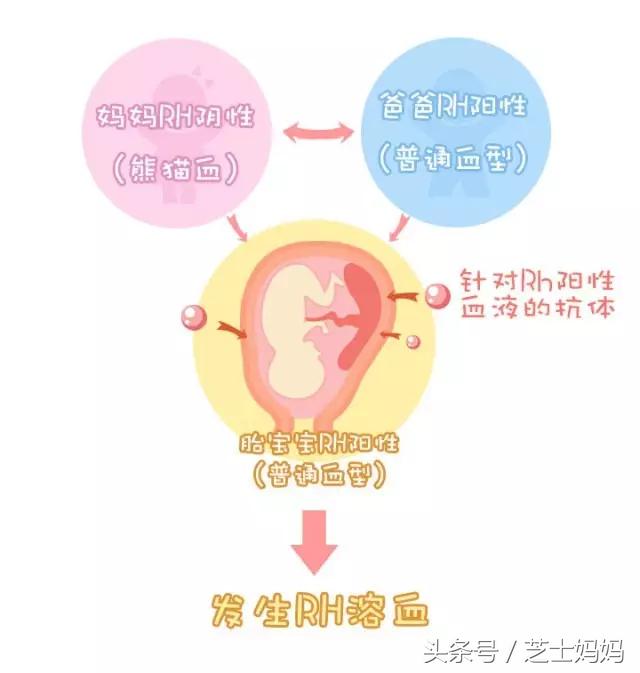 熊猫血生娃的成功率高吗,熊猫血如何生二胎