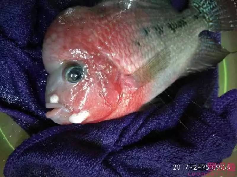 头洞治疗详细过程，你值得拥有！