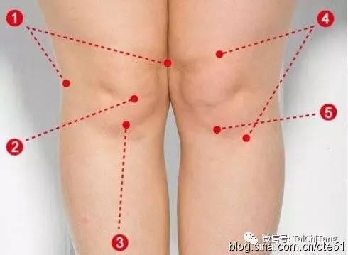 中医治疗膝关节积液的中药方剂,膝关节积液可以用拔罐清除积液吗