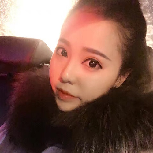 全切双眼皮疤痕增生多久可以恢复,全切双眼皮恢复过程经历真实