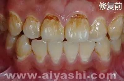 我们的牙齿是怎么来的,我们的牙齿是哪来的