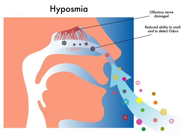 嗅觉味觉失灵挂号挂什么科,哪个医院看嗅觉失灵最好