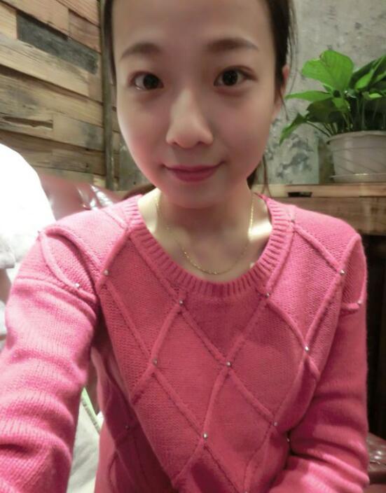 完美的埋线双眼皮,完美双眼皮