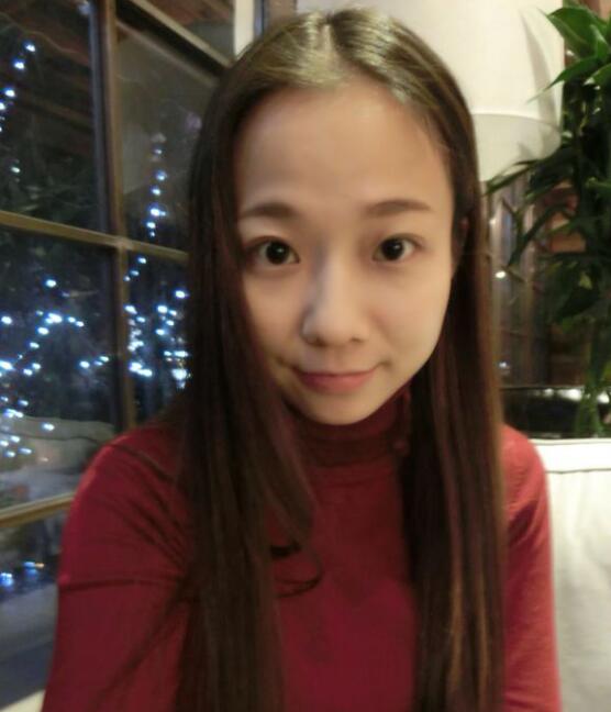 完美的埋线双眼皮,完美双眼皮