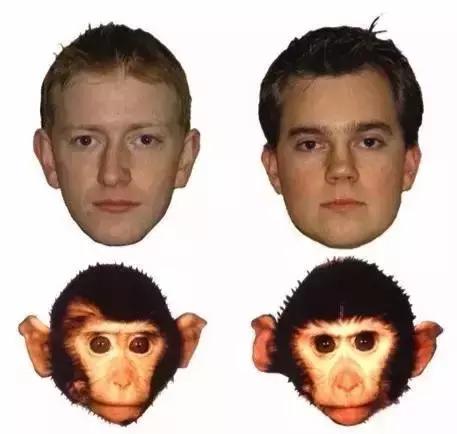 有脸盲症怎么治疗,怎么治愈脸盲症