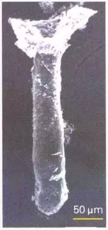 普通内镜与Pitpattern分型（多图详解）