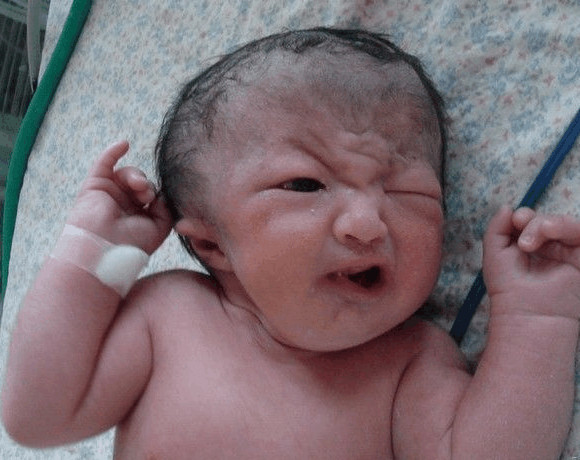 因为想生男孩，女子喝了生男孩神药调理，结果生下畸形婴儿