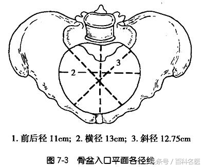 产后骨盆和正常骨盆的区别,骨盆测量有意义吗