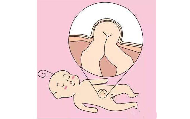 小儿脐疝脐带四周会鼓起吗,新生儿腹股沟脐疝如何用硬币按压