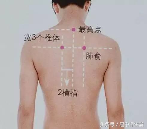 一味中药解除湿疹,湿疹千万不要慌可以用这几个方法