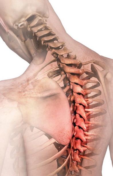 后背疼痛到医院检查正常怎么治疗,后背疼痛怎么治疗最好的方法