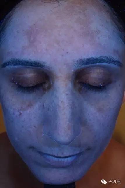 有防晒指数的粉底可以代替抹防晒霜吗？为什么防晒还是晒黑了呢？关于防晒的一切都在这里了