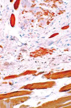 内镜做病理分析大概多久,作为一个医生太感性怎么办