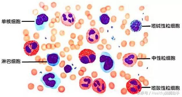 白细胞低感染了有什么症状,白细胞低引发细菌感染