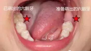 小孩子换的牙齿为什么越来越丑,小孩换的新牙又掉了怎么办