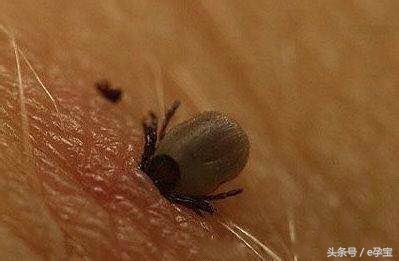 2岁女童反复高烧查不出原因,2岁娃高烧不退