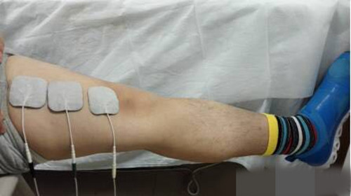 膝关节骨性关节炎的诊断标准,什么是膝关节骨性关节炎阶梯治疗