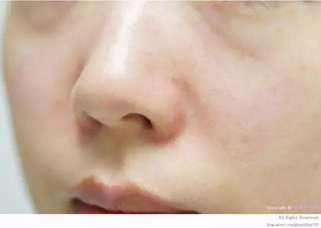 7合一清洁面膜,敏感皮肤清洁面膜去黑头