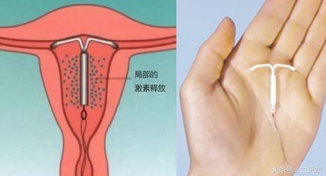 老中医致不孕不育,老中医治疗不育可信吗