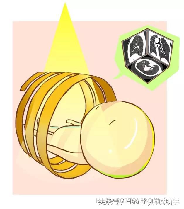 患者发生大咯血时应采取什么卧位,病人大咯血发作时应如何处理