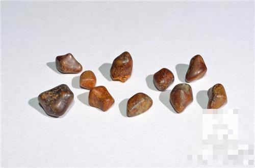 胆结石为什么吃太饱会痛,为什么会得胆结石要注意哪些饮食