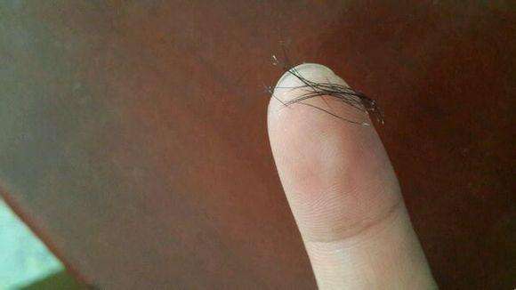 拔毛癖长头发,拔毛癖会拔别人的头发么