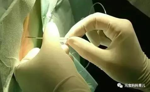 为什么有人生孩子不痛?这个秘密你需要知道!