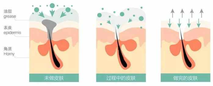 五合一超微小气泡嫩肤仪,天津美莱吸脂怎么样