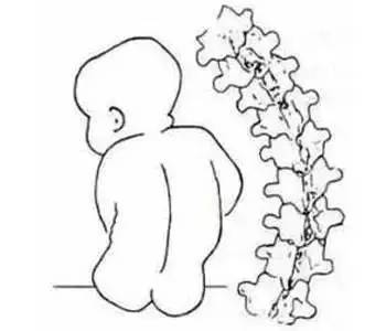 婴儿车对宝宝颈椎不好吗,婴儿车会伤婴儿的脊椎发育吗