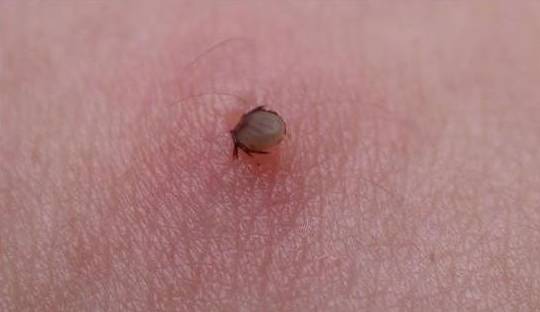 2岁男宝呕吐发烧,一周岁男孩呕吐发烧