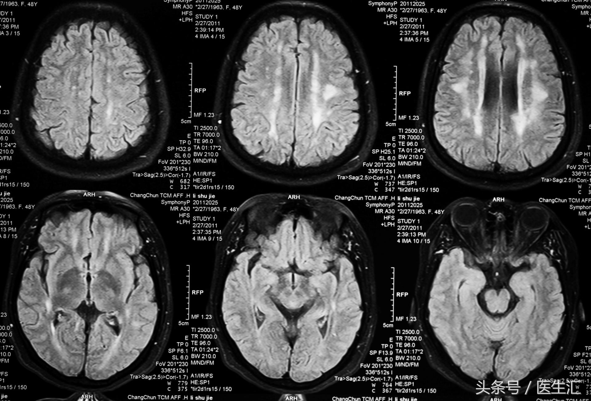 神经内科疾病诊断公式,神经系统疾病的诊断思路及步骤