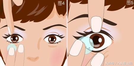 日抛隐形眼镜怎么摘取佩戴,隐形眼镜速摘