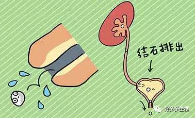 肾积水引发的尿漏怎么办,肾积水排尿困难吃什么药