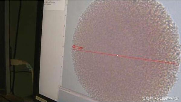 黑色素瘤转移无靶向药能救吗,转移性恶性黑色素瘤找不到原发灶