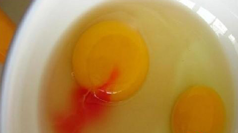 恐怕最近梅方走上球场都会有种蛋蛋的忧伤,踢球伤到蛋,咋整?