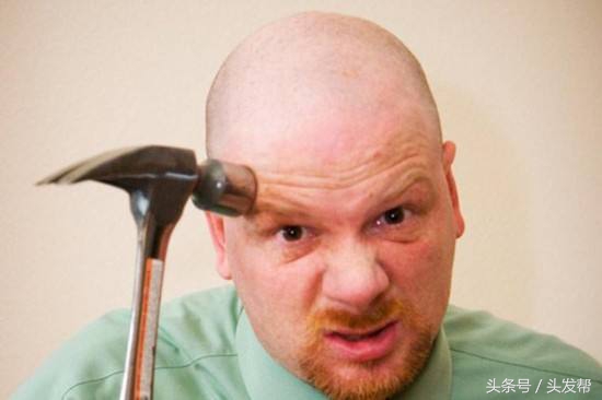 脱发到底都是什么原因,都有哪些原因?你又中招了吗?