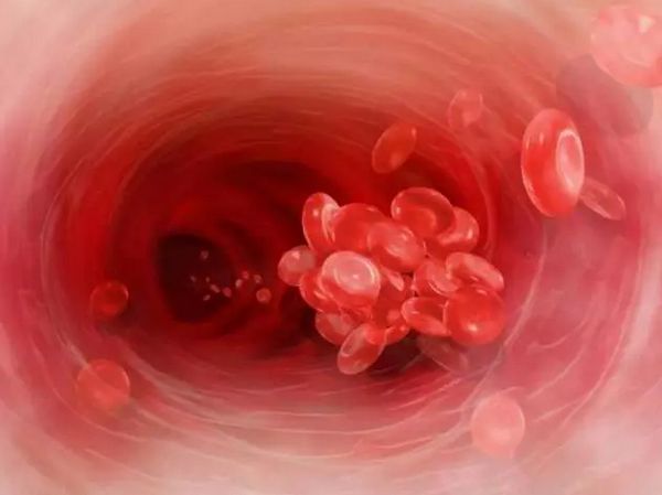 血里有油脂吃什么水果,血里有油吃什么清得快