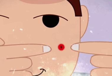 祛痘神器痘痘的克星,和痘痘疯狂抗争的经历