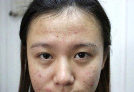 唯恩诗对敏感肌肤有效吗,唯恩诗柔肤乳