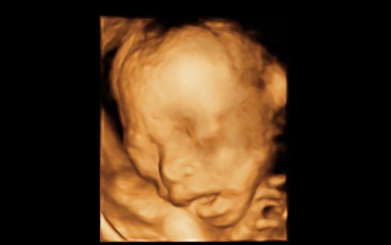 孕早期多久做一次b超比较合适,孕期一共要做几次b超合适