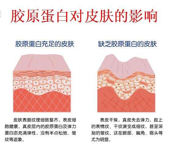 超声刀是什么副作用,超声刀是什么