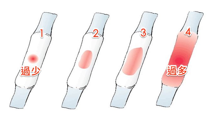 月经过多是什么疾病,月经量突然增多要小心五种病