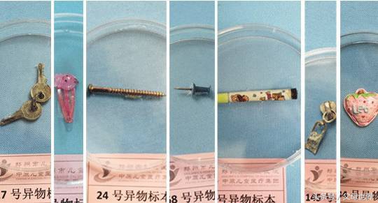 警惕孩子的四个安全意外,宝宝误食小物急救方法