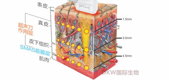 逆龄抗衰超声刀,逆龄超声刀效果怎么样